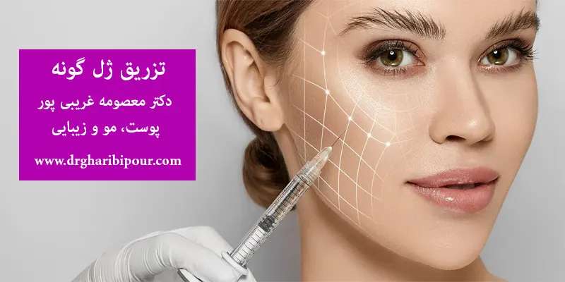 تزریق-ژل-گونه