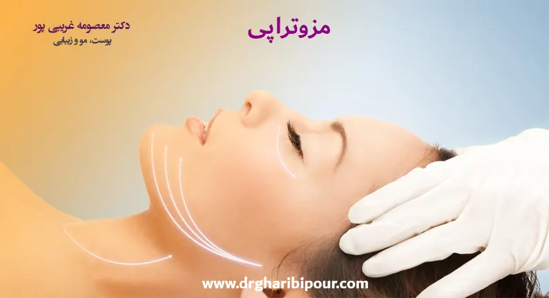 مزوتراپی-در-کرج