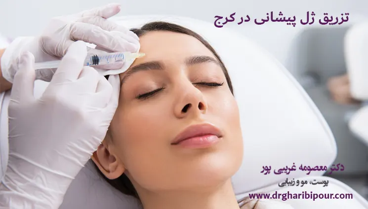 تزریق ژل پیشانی در کرج