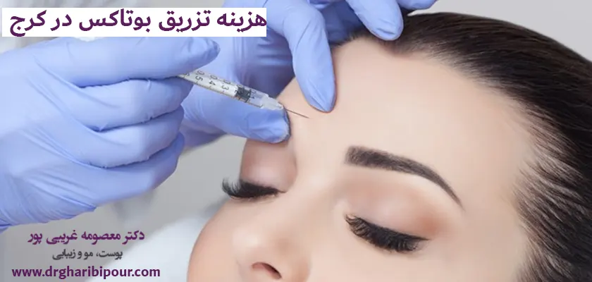 هزینه-تزریق-بوتاکس-در-کرج