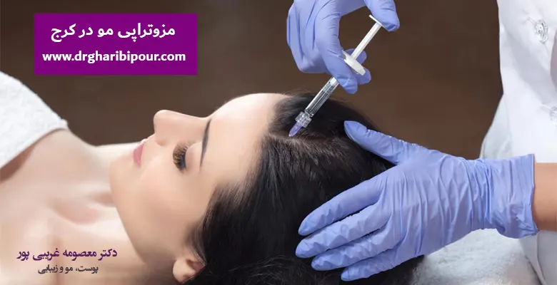 قیمت مزوتراپی مو
