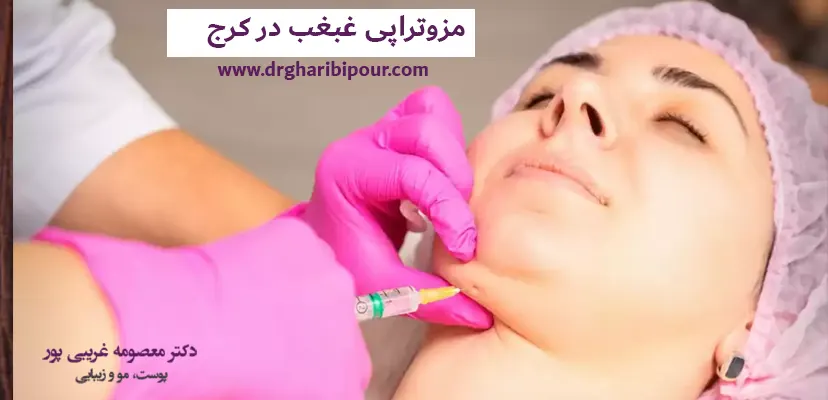 مزوتراپی غبغب در کرج
