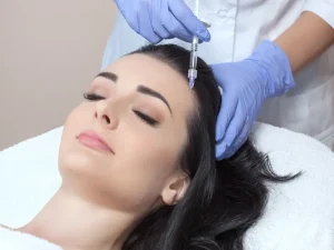 مزوتراپی موی سر