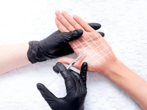 هزینه تزریق بوتاکس کف دست