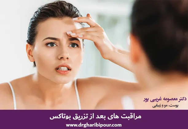 مراقبت های بعد از تزریق بوتاکس