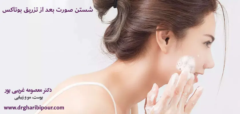 شستن صورت بعد از تزریق بوتاکس