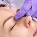 تزریق بوتاکس پیشانی