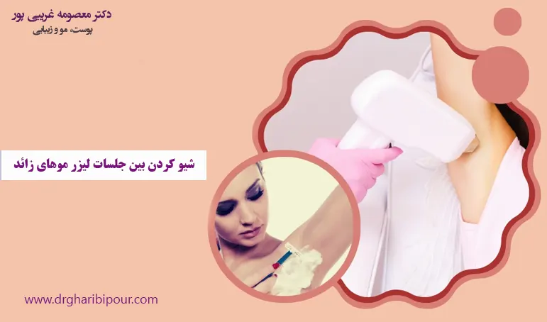 شیو کردن بین جلسات لیزر موهای زائد